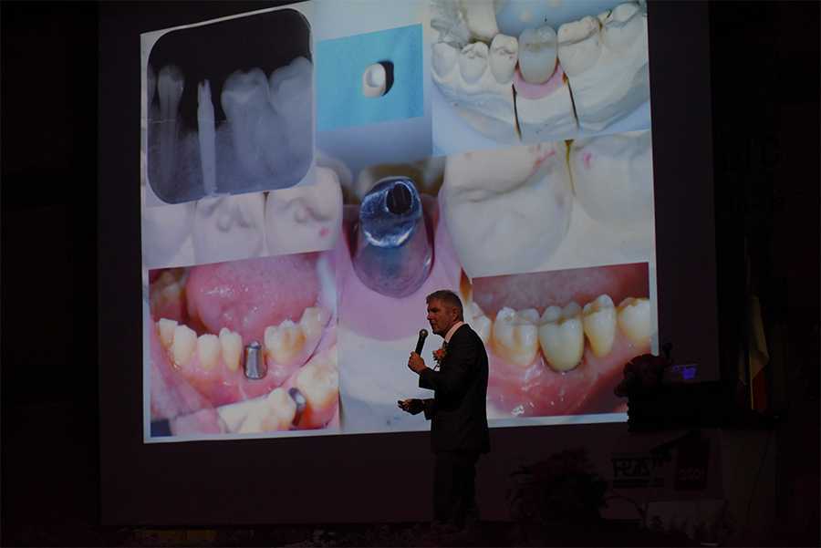 Dr. Fred Bergmann President of the German society for oral implantology (DGOI) by Dental Chiang Mai